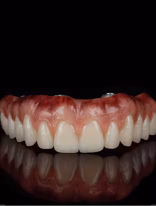 All-On-X@1.2x_converted